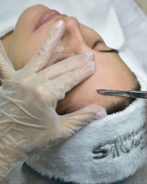 LIMPIEZA FACIAL CON DERMAPLANING