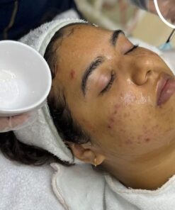 PACK ACNE AVANZADO