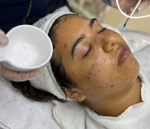 PACK ACNE AVANZADO