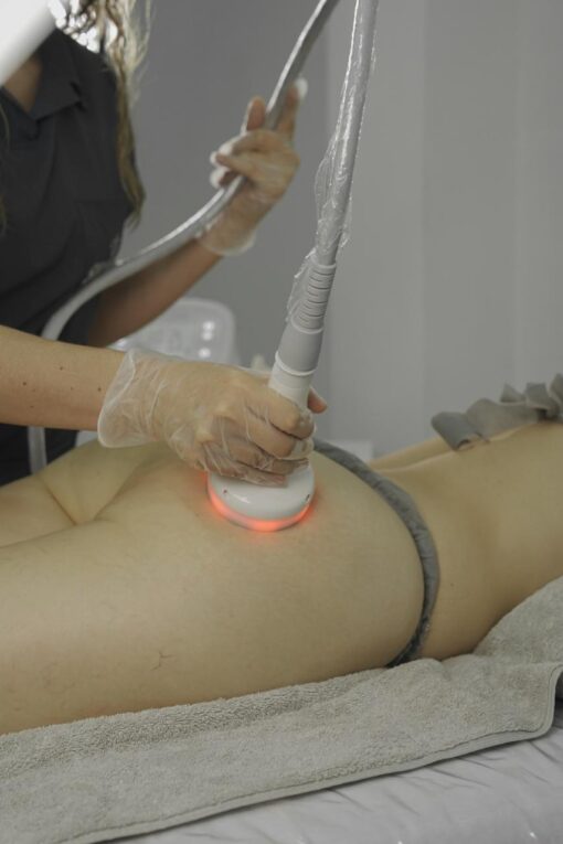 TRATAMIENTO DE CELULITIS