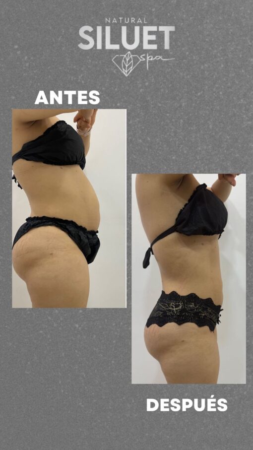 LIPOFLASH  PACK REDUCTOR