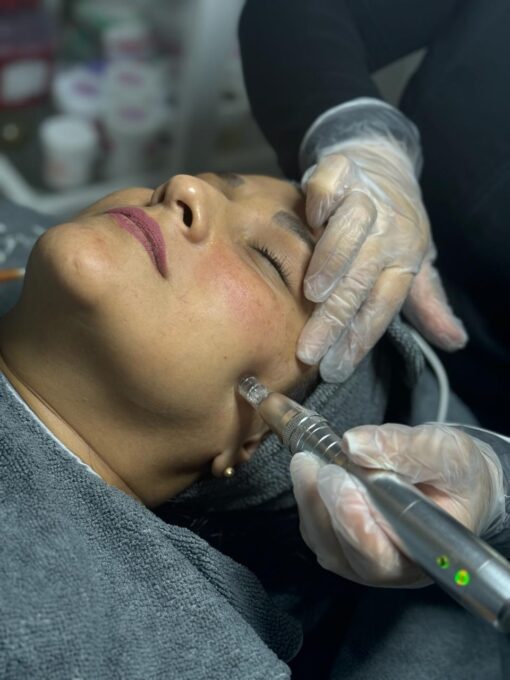 DERMAPEN